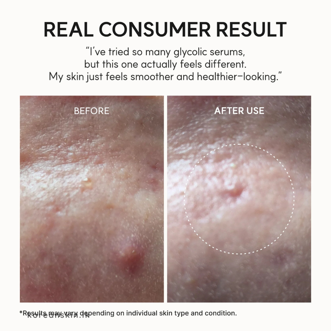 Arencia Eraser Shot Glycolic Acid Booster 30ml