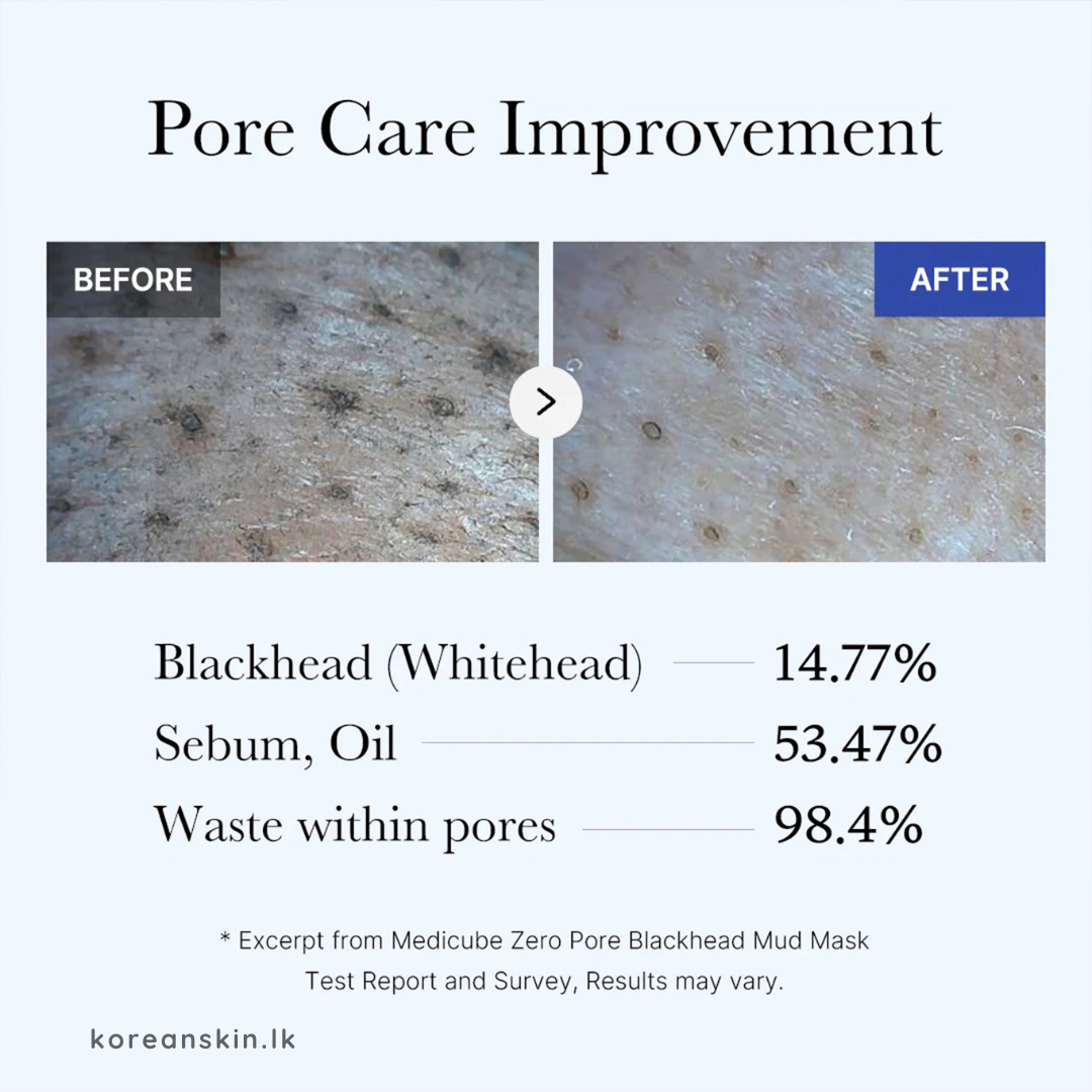 Medicube Zero Pore Blackhead Mud Mask 100g