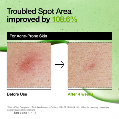 Anua Azelaic Acid 10 Hyaluron Redness Soothing Serum 30ml