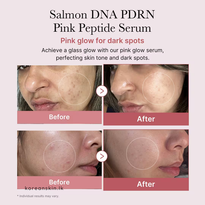 Medicube PDRN Pink Peptide Serum 30ml